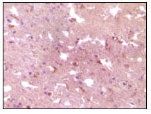 Mouse Monoclonal Antibody to APP