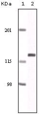 Mouse Monoclonal Antibody to EphA2