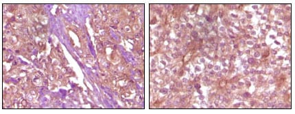 Mouse Monoclonal Antibody to EphB4