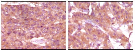 Mouse Monoclonal Antibody to SRA