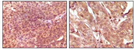 Mouse Monoclonal Antibody to SRA