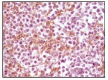 Mouse Monoclonal Antibody to SNCA