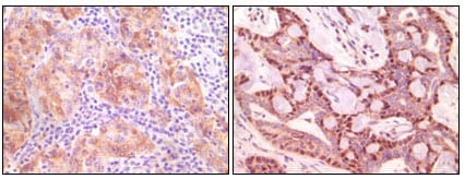 Mouse Monoclonal Antibody to SNCG (breast cancer-specific protein 1)