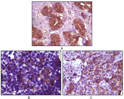 Mouse Monoclonal Antibody to BLK