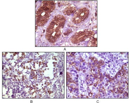 Mouse Monoclonal Antibody to BLK