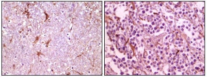Mouse Monoclonal Antibody to CIB1