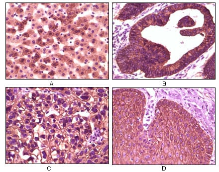 Mouse Monoclonal Antibody to CK1