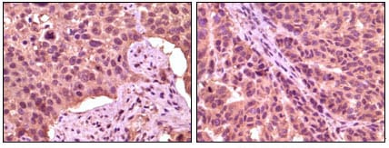 Mouse Monoclonal Antibody to GSK3 alpha