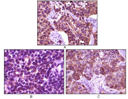 Mouse Monoclonal Antibody to BLK
