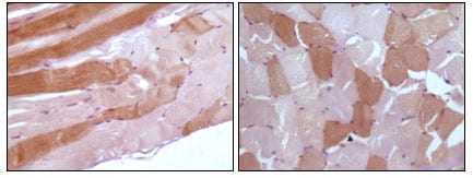 Mouse Monoclonal Antibody to Myoglobin