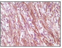 Mouse Monoclonal Antibody to Desmin