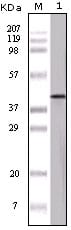 Mouse Monoclonal Antibody to OVA