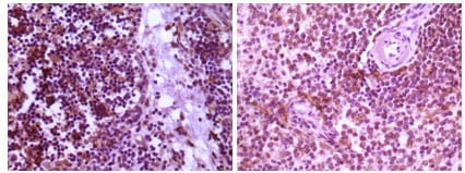 Mouse Monoclonal Antibody to MAP2K4