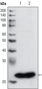 HOTMouse Monoclonal Antibody to GSTP1