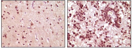 Mouse Monoclonal Antibody to ELK1