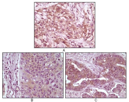 Mouse Monoclonal Antibody to 4E-BP1