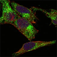 Mouse Monoclonal Antibody to INHA (Inhibin alpha)