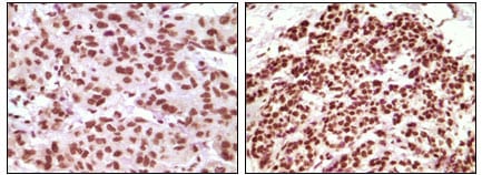 Mouse Monoclonal Antibody to PR