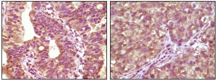 Mouse Monoclonal Antibody to BRAF
