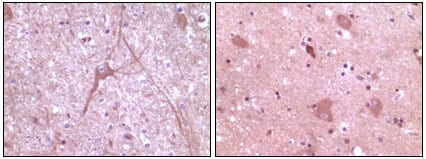 Mouse Monoclonal Antibody to Dynamin-2