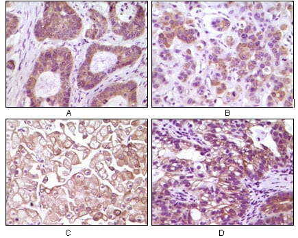 Mouse Monoclonal Antibody to IKBKB