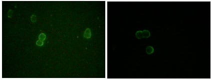 Mouse Monoclonal Antibody to ApoM