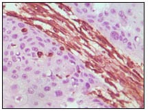 Mouse Monoclonal Antibody to Vimentin