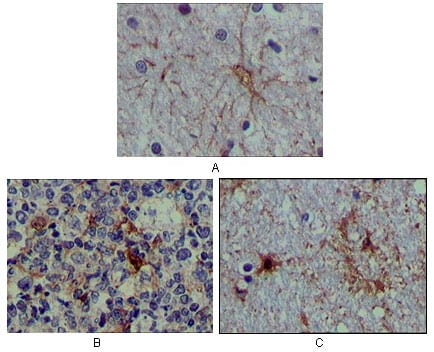 Mouse Monoclonal Antibody to S100A1