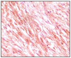 Mouse Monoclonal Antibody to C-Kit