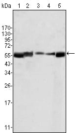Mouse Monoclonal Antibody to LYN