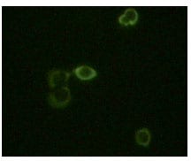 Mouse Monoclonal Antibody to ABL2