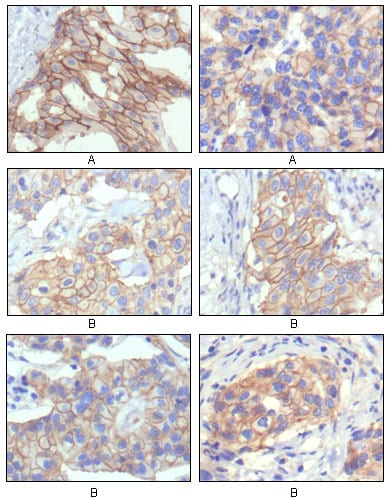 Mouse Monoclonal Antibody to HER-2
