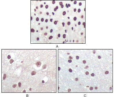 Mouse Monoclonal Antibody to P16 (Mouse and Human)