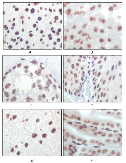 Mouse Monoclonal Antibody to P16 (Mouse and Human)