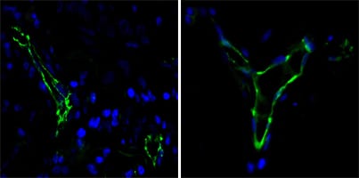 Mouse Monoclonal Antibody to CD31