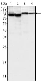 Mouse Monoclonal Antibody to BTK