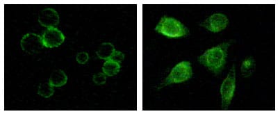 Mouse Monoclonal Antibody to TYRO3