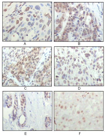 Mouse Monoclonal Antibody to RSK1