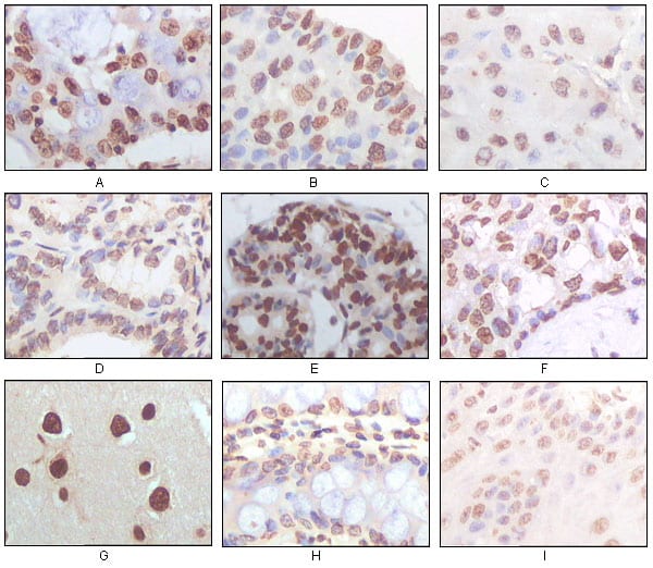 Mouse Monoclonal Antibody to Human P16