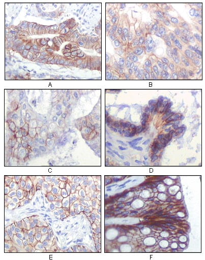 Mouse Monoclonal Antibody to IGF1R-Beta
