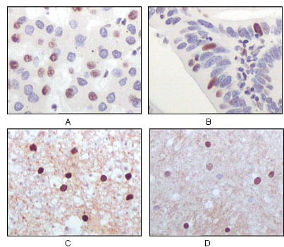 Mouse Monoclonal Antibody to TIP60