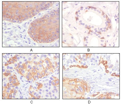 Mouse Monoclonal Antibody to Cytokeratin 5