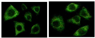 Mouse Monoclonal Antibody to Cytokeratin (Pan)