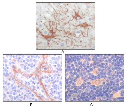 Mouse Monoclonal Antibody to FES