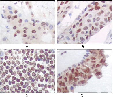 Mouse Monoclonal Antibody to PRAK