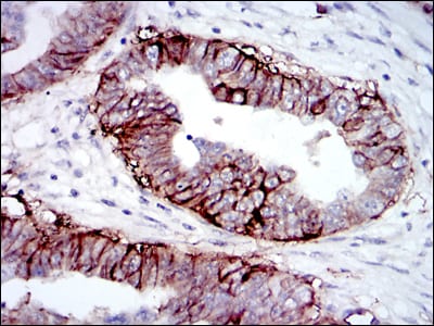 Mouse Monoclonal Antibody to IGF1R-Beta