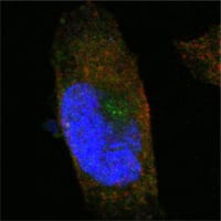 Mouse Monoclonal Antibody to SORL1