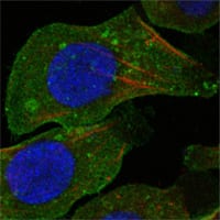 Mouse Monoclonal Antibody to DDR2