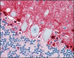Mouse Monoclonal Antibody to S100B