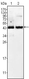 Mouse Monoclonal Antibody to AMACR